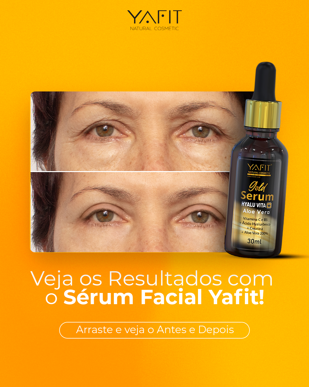 Veja-os-Resultados-com--o-Sérum-Facial-Yafit!_01